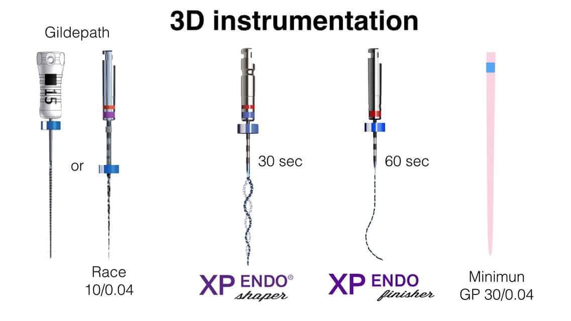 FKG XP Endo Shaper 31mm Iso 30 6st